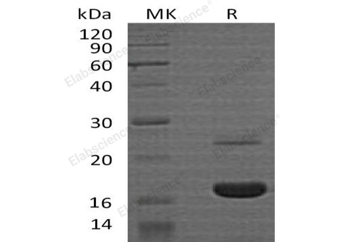 Recombinant Human MYDGF Protein (His Tag)