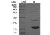 Recombinant Human MYDGF Protein (His Tag)