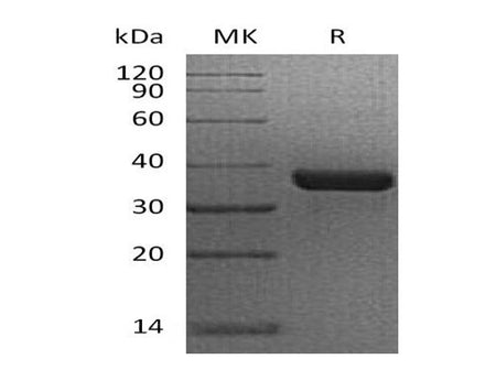 Recombinant Human N-Glycosylase/OGG1 Protein (GST Tag)