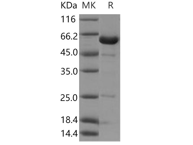 Recombinant Human NCF2/P67phox Protein