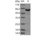 Recombinant Human NCF2/P67phox Protein