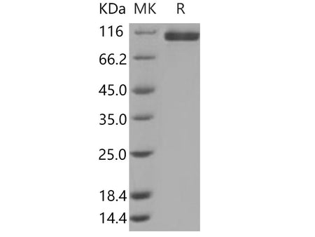 Recombinant Human Neuropilin-2/NRP2 Protein (His Tag)(Active)