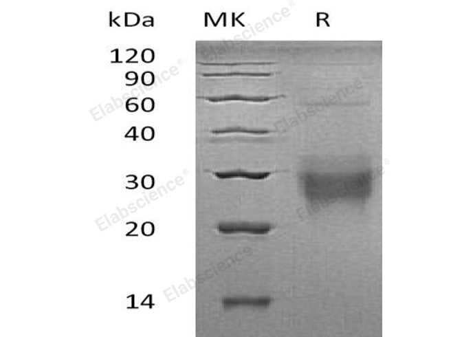 Recombinant Human NFYA Protein (GST Tag)