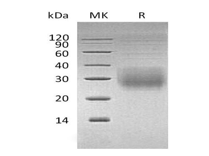 Recombinant Human NKG2A & CD94 Heterodimer Protein (His & Flag Tag) 