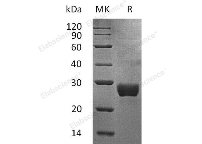 Recombinant Human NKG2DL/ULBP-1 Protein (His Tag)