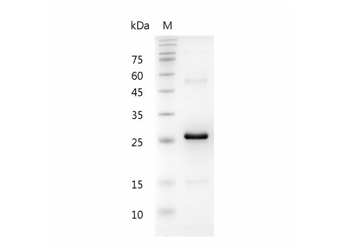 Recombinant Human Noggin protein(C-His)(active)