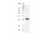 Recombinant Human Noggin protein(C-His)(active)
