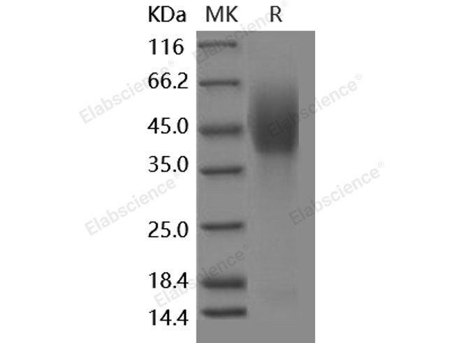 Recombinant Human NPC1 Protein (His & FLAG Tag)
