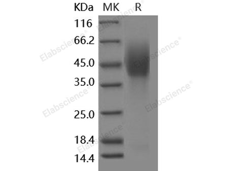 Recombinant Human NPC1 Protein (His & FLAG Tag)