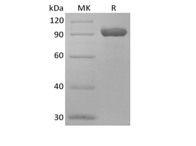 Recombinant Human NPRC/NPR3 (C-Fc)