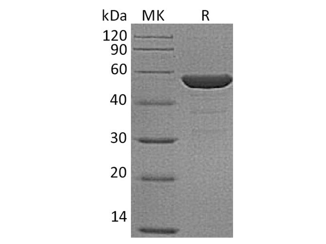 Recombinant Human NSE/ENO2 Protein (His Tag)