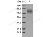 Recombinant Human OBCAM/OPCML Protein (His Tag)