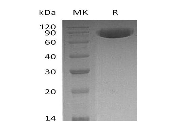 Recombinant Human OX-2/MOX1/CD200 Protein (Fc Tag)