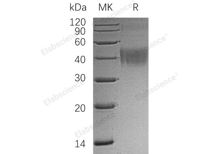 Recombinant Human OX-2/MOX1/CD200 Protein (His Tag)