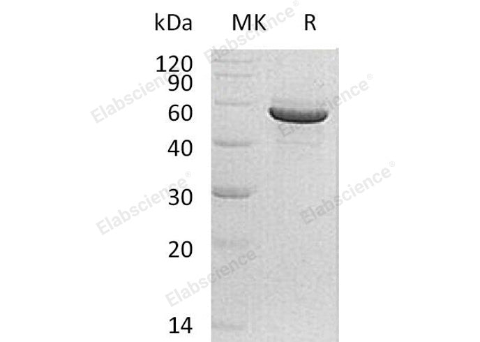 Recombinant Human PACSIN1/Syndapin-1 Protein (His Tag)