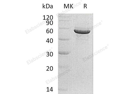Recombinant Human PACSIN1/Syndapin-1 Protein (His Tag)