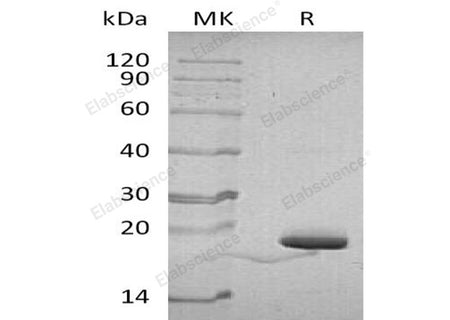Recombinant Human Parvulin-14/PIN4 Protein (His Tag)