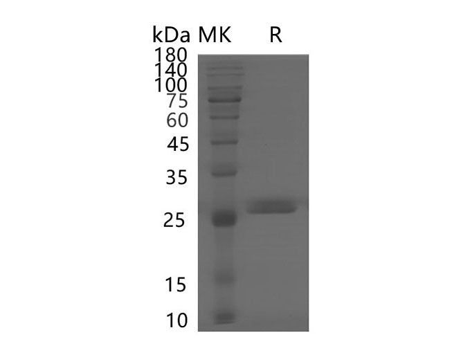 Recombinant Human PF4V1 Protein (Fc Tag)