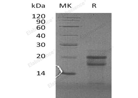 Recombinant Human PFDN4 Protein (His Tag)