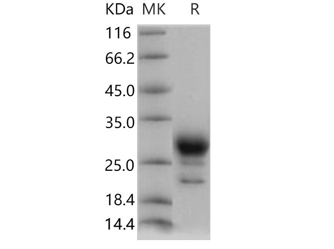 Recombinant Human PGD2 Synthase/PTGDS Protein (His Tag)
