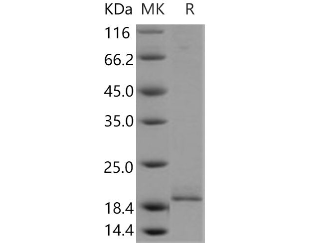 Recombinant Human PPP3R1 Protein (His Tag)(Active)