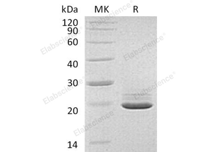 Recombinant Human PRAP1 Protein (His Tag)