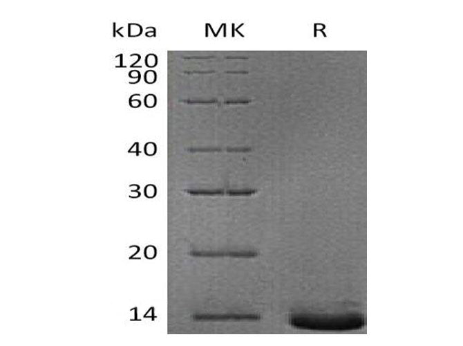 Recombinant Human Pro-Neuropeptide Y/NPY Protein (His Tag)
