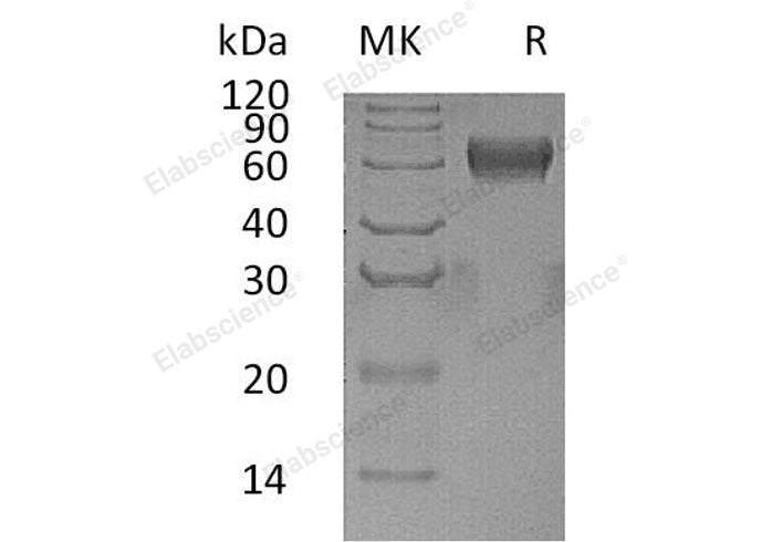 Recombinant Human PSG1 Protein (His Tag)