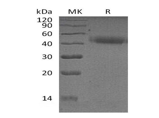 Recombinant Human PSG2 Protein (His Tag)