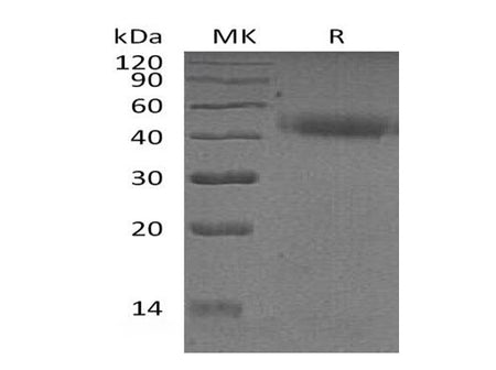 Recombinant Human PSG2 Protein (His Tag)