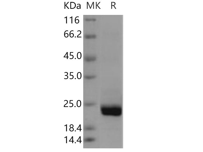 Recombinant Human PTPMT1 Protein (His Tag)(Active)