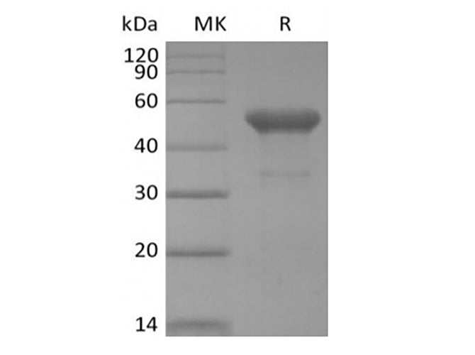 Recombinant Human PVRIG (C-mFc) Expression Host HEK293 Cells