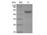 Recombinant Human PVRIG (C-mFc) Expression Host HEK293 Cells