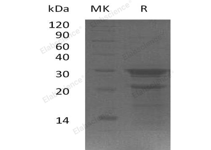 Recombinant Human PYM1/WIBG Protein (His Tag)