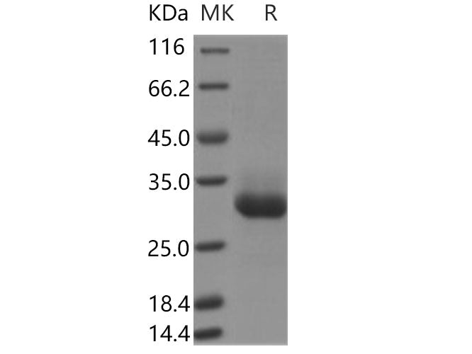 Recombinant Human RAB11B Protein (His Tag)