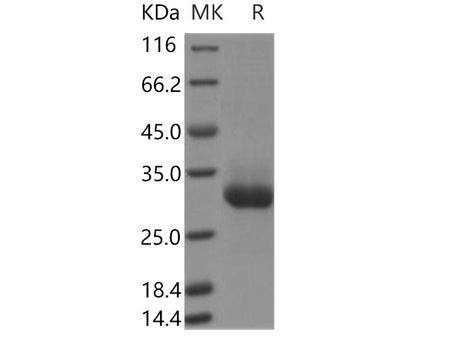 Recombinant Human RAB11B Protein (His Tag)