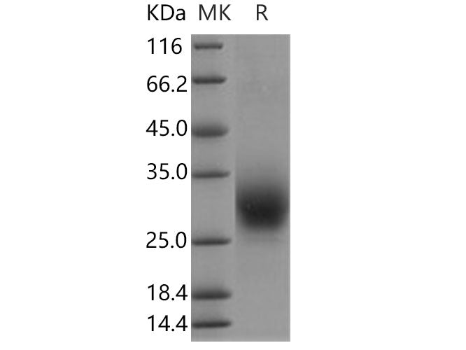 Recombinant Human RAMP3 Protein (Fc Tag)
