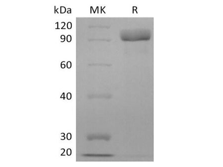 Recombinant Human Receptor Tyrosine-Protein Kinase ErbB-3/HER3 (C-6His)