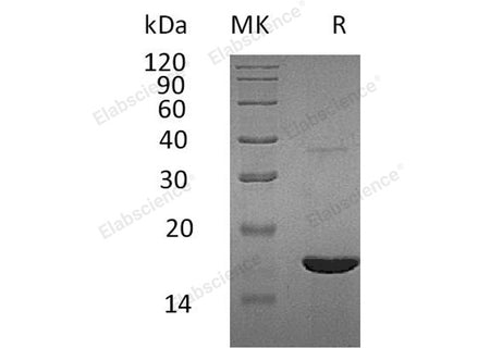 Recombinant Human REG3G/PAP-1B Protein (His Tag)