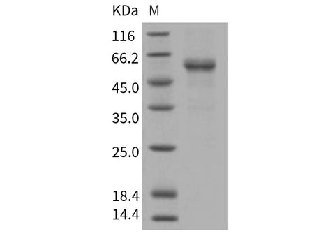 Recombinant Human RELT/TNFRSF19L Protein (His & Fc Tag)