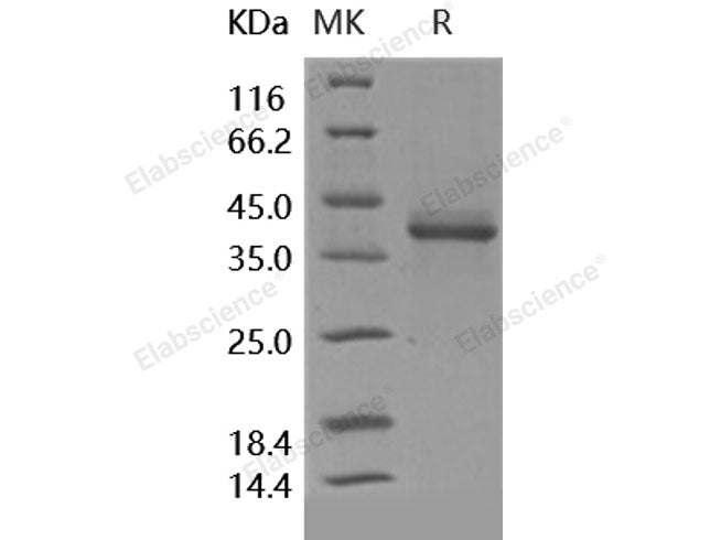 Recombinant Human S100A1 Protein (Fc Tag)(Active)