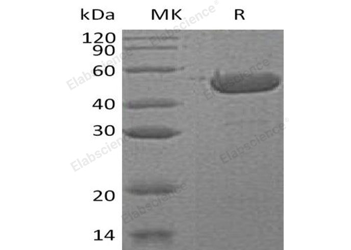 Recombinant Human Sedoheptulokinase/SHPK Protein (His Tag)