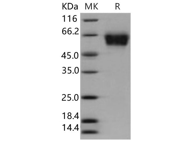Recombinant Human SELL Protein (His Tag)