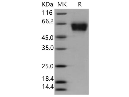 Recombinant Human SELL Protein (His Tag)
