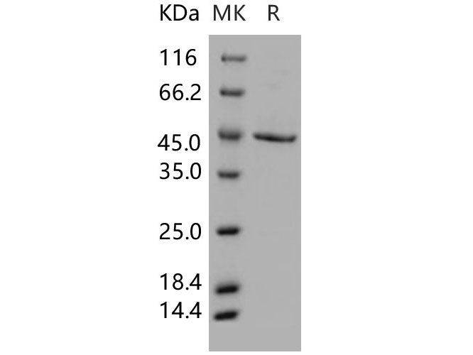 Recombinant Human SERPINB1/PI2 Protein (Baculovirus, His Tag)