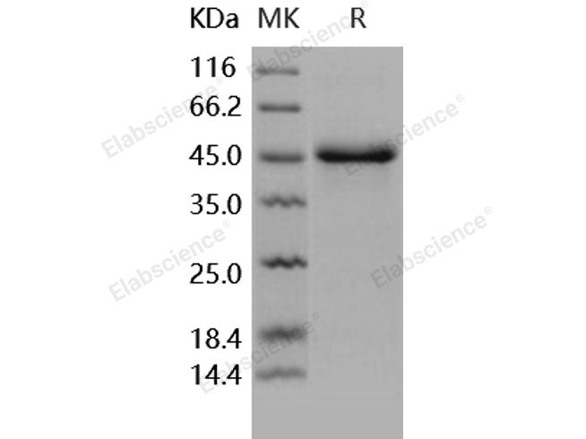 Recombinant Human SerpinE1/PAI-1 Protein (His Tag)(Active)