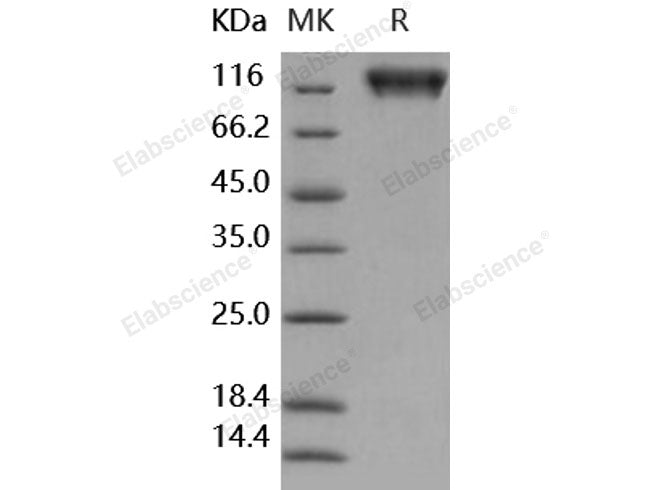 Recombinant Human SerpinF2/SERPINF2 Protein (His Tag)(Active)