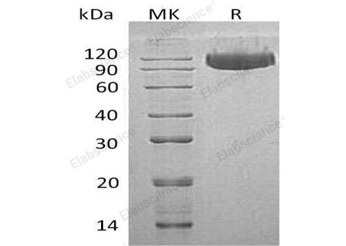 Recombinant Human SerpinG1/C1IN Protein (His Tag)