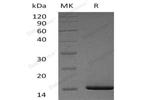 Recombinant Human Serum Amyloid A1/SAA1 Protein (His Tag)