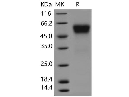 Recombinant Human sFRP4 Protein (His Tag)(Active)